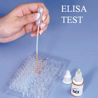 elisa kit full form|consent form for elisa.